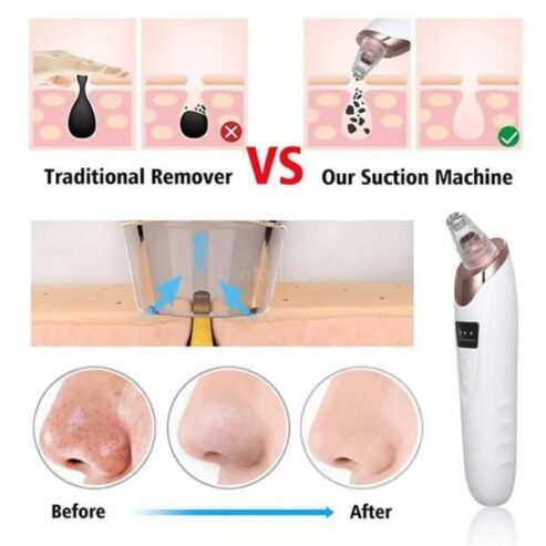 Black heads removing tool